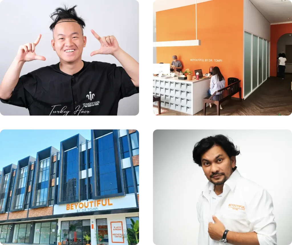 Home Hair Restoration Excellence You Can Trust