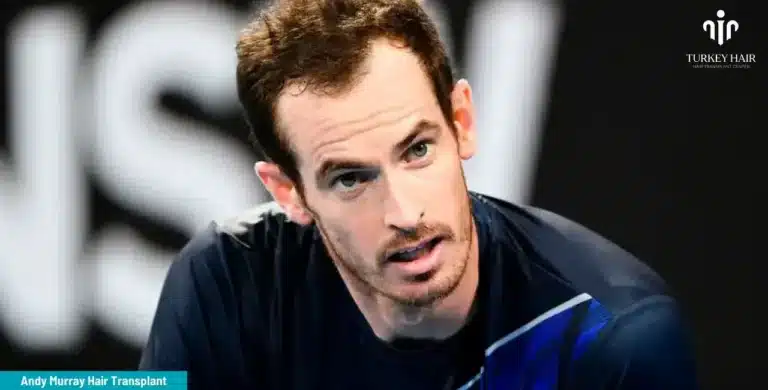 Andy-Murray-Hair-Transplant-3-1-768X390 Britain’s Number 1 Tennis Player Andy Murray’s Hair Transplant Hair Restoration Excellence You Can Trust