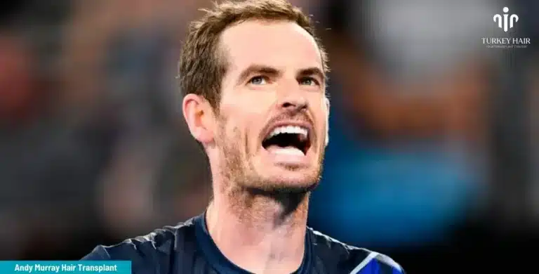 Andy-Murray-Hair-Transplant-4-1-768X390 Britain’s Number 1 Tennis Player Andy Murray’s Hair Transplant Hair Restoration Excellence You Can Trust