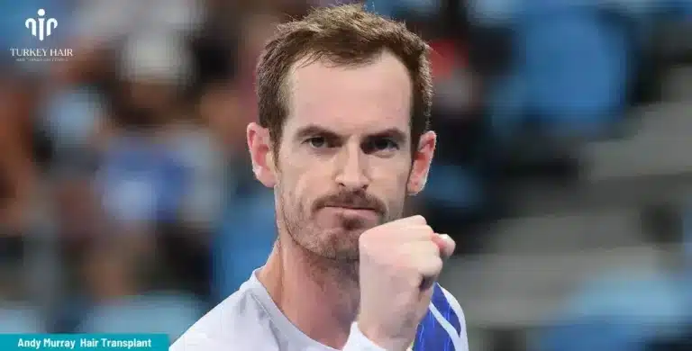 Andy-Murray-Hair-Transplant-6-1-768X390 Britain’s Number 1 Tennis Player Andy Murray’s Hair Transplant Hair Restoration Excellence You Can Trust