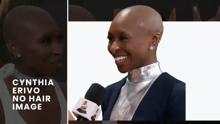 Cynthia-Erivo-No-Hair-Image-768X432 Cynthia Erivo Hair Journey Hair Restoration Excellence You Can Trust