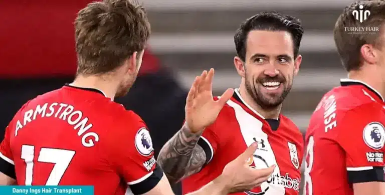 Danny-Ings-Hair-Transplant-17-768X390 Let’s Discover Succesfull Striker Danny Ings’ Hair Transplant 2026 Hair Restoration Excellence You Can Trust