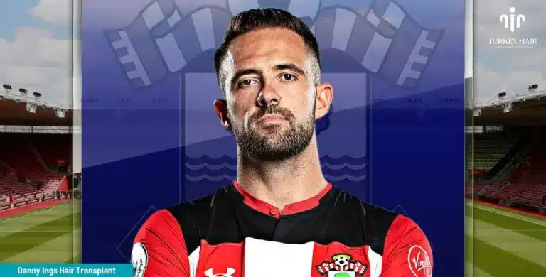 Danny-Ings-Hair-Transplant-8-768X390 Let’s Discover Succesfull Striker Danny Ings’ Hair Transplant 2026 Hair Restoration Excellence You Can Trust