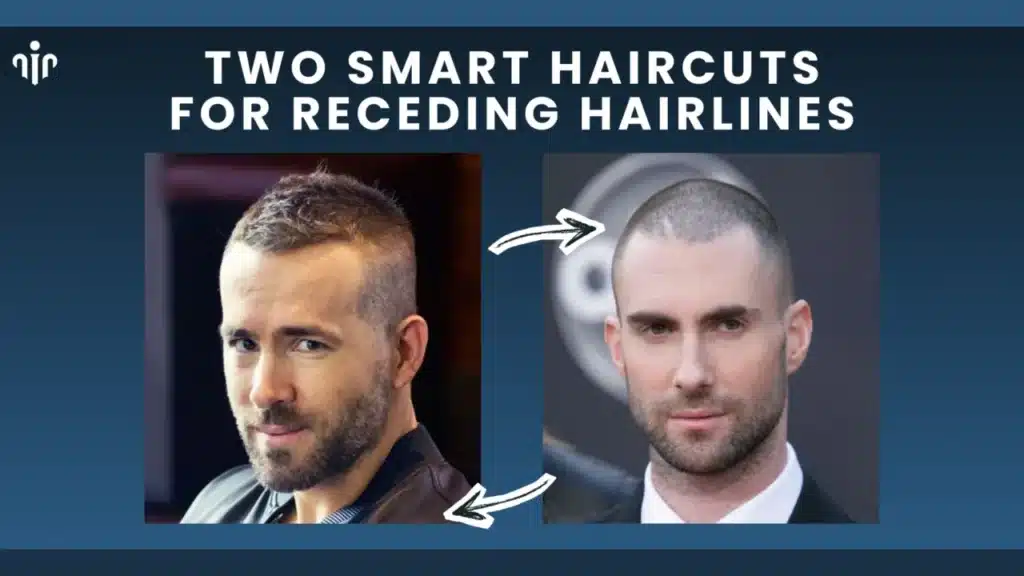 Top Men’s Hairstyles That Suit Receding Or Balding Hairlines Hair Restoration Excellence You Can Trust