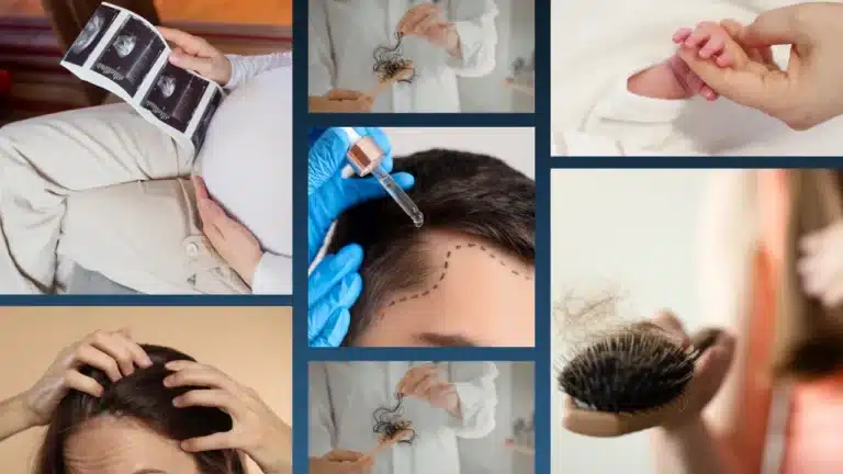Postpartum Hair Loss Guide: Causes, Recovery And Healthy Regrowth Hair Restoration Excellence You Can Trust