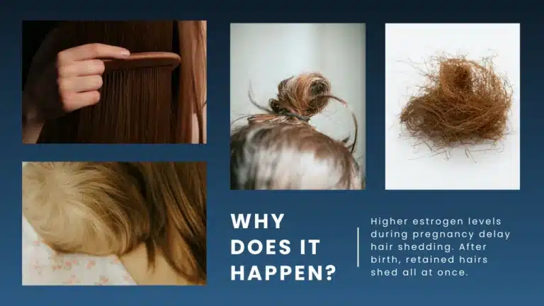 Postpartum Hair Loss Guide: Causes, Recovery And Healthy Regrowth Hair Restoration Excellence You Can Trust