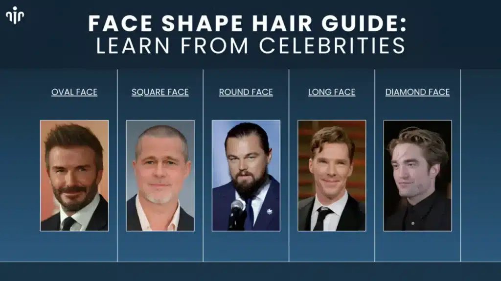 Top Men’s Hairstyles That Suit Receding Or Balding Hairlines Hair Restoration Excellence You Can Trust