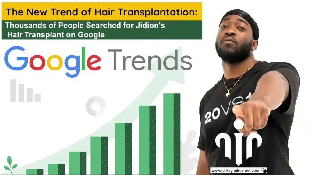 Img_5613-_1_ Rumors About Jidion Hair Transplant Before And After Hair Restoration Excellence You Can Trust