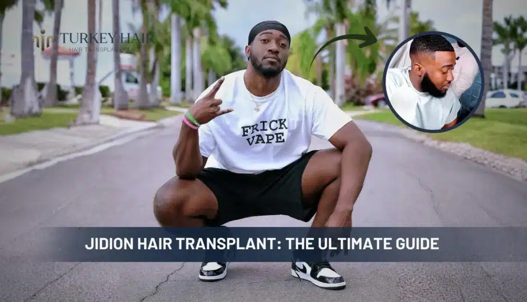 Jidion-Hair-Transplant-1024X587 Rumors About Jidion Hair Transplant Before And After Hair Restoration Excellence You Can Trust