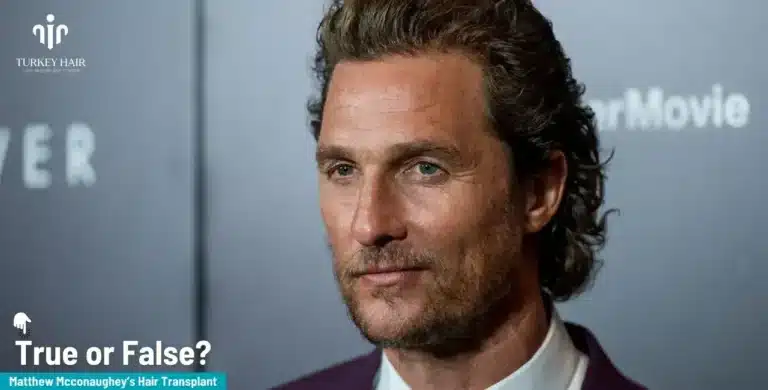 Matthew-Mcconaughey-6-1-768X390 Matthew Mcconaughey Hair Transplant: The Brutal Truth Hair Restoration Excellence You Can Trust