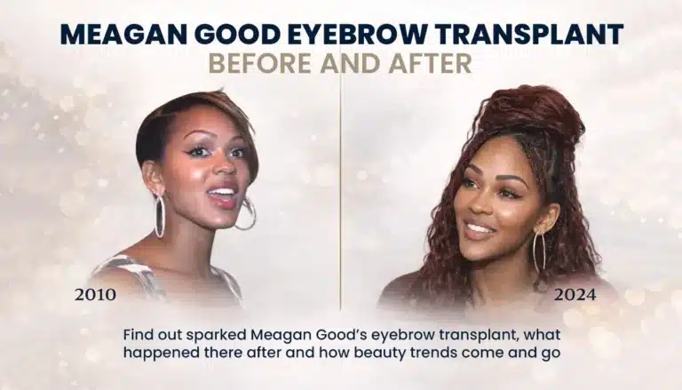 Meagan-Good-Eyebrow-Transplant-Before-And-After-Comparison-768X439 Meagan Good Eyebrow Transplant Before And After Hair Restoration Excellence You Can Trust