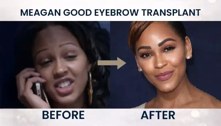 Meagan-Goods-Microblading-Phase-768X439 Meagan Good Eyebrow Transplant Before And After Hair Restoration Excellence You Can Trust