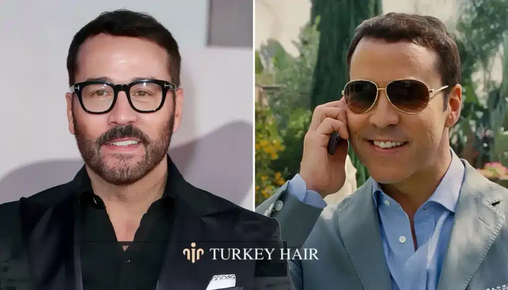 Natural-Look-Hair-Direction-And-Symmetry-1344X768 Jeremy Piven Hair Transplant – Before And After Hair Restoration Excellence You Can Trust