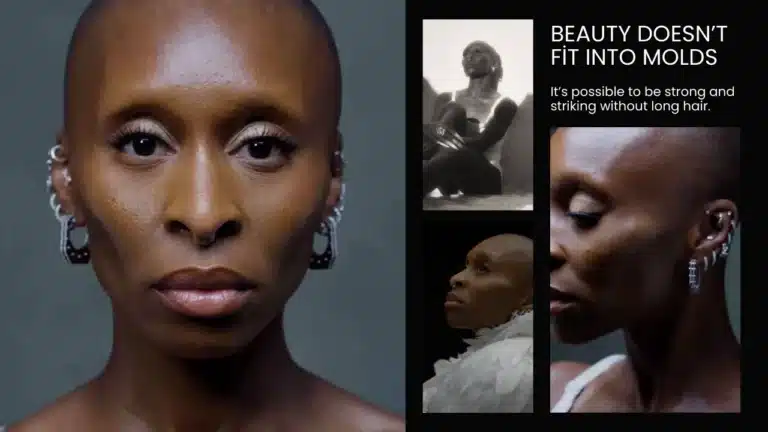 Redefining-Beauty-Standards-In-The-Entertainment-Industry-768X432 Cynthia Erivo Hair Journey Hair Restoration Excellence You Can Trust