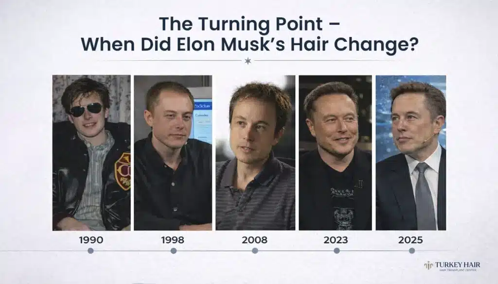The-Turning-Point-When-Did-Elon-Musks-Hair-Change- Elon Musk Hair Transplant: Fut &Amp; Fue Before/After Analysis Hair Restoration Excellence You Can Trust
