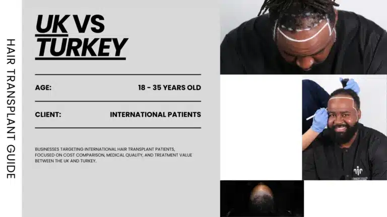 Uk-For-Hair-Transplant-Surgery-2-768X432 Hair Transplant Uk Vs Turkey – Cost, Quality And Key Facts Hair Restoration Excellence You Can Trust