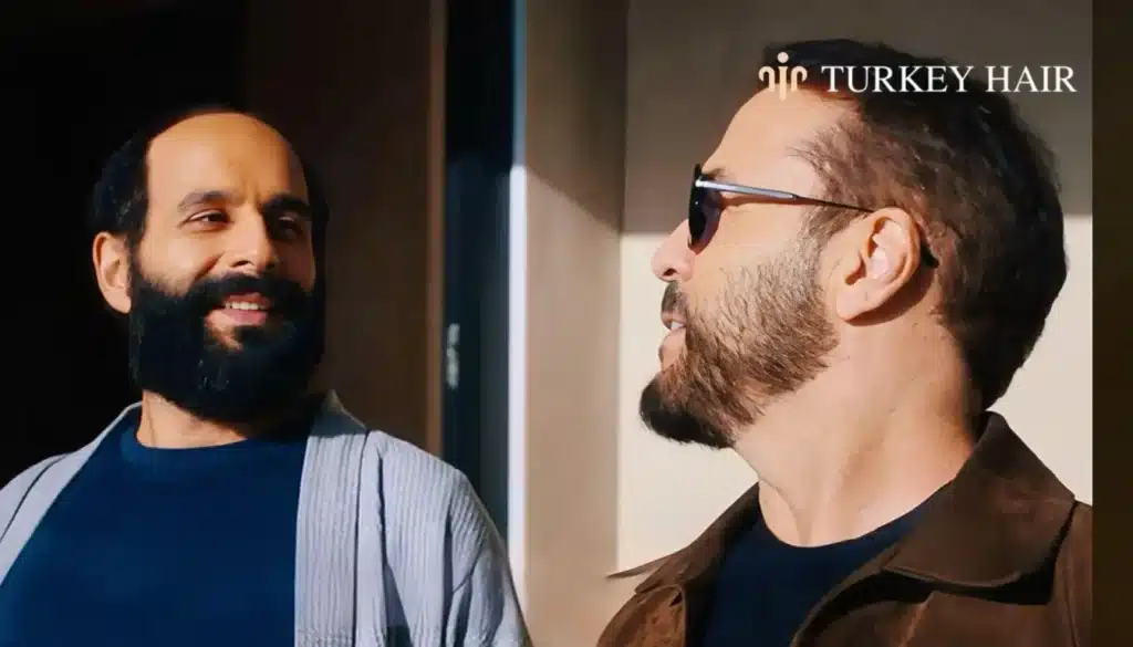 Was-Jeremy-Pivens-Hair-Transplant-Successful-1344X768 Jeremy Piven Hair Transplant – Before And After Hair Restoration Excellence You Can Trust