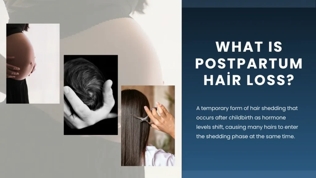 Postpartum Hair Loss Guide: Causes, Recovery And Healthy Regrowth Hair Restoration Excellence You Can Trust