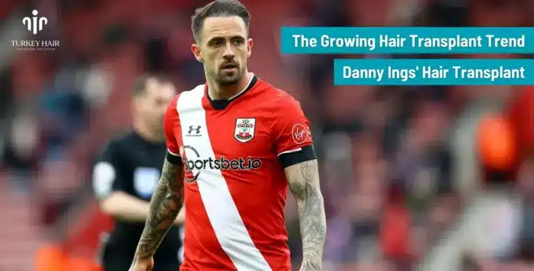 Danny-Ings-Hair-Transplant-5-1-768X390 Let’s Discover Succesfull Striker Danny Ings’ Hair Transplant 2026 Hair Restoration Excellence You Can Trust