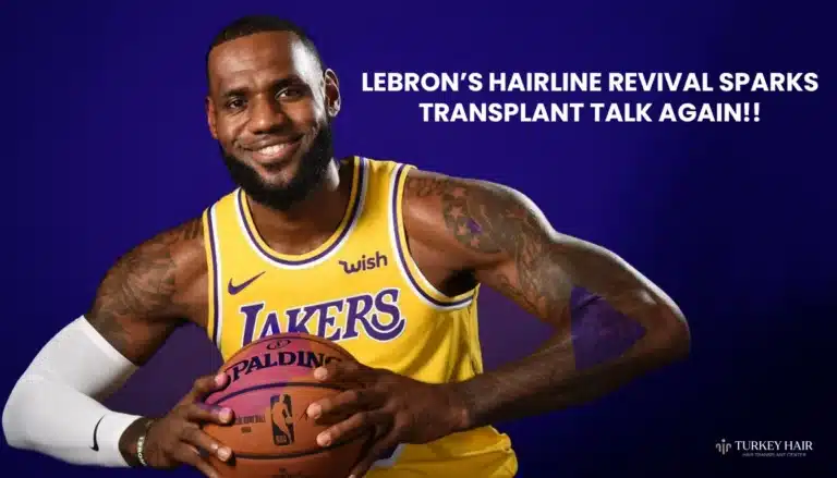 Lebron-James-Hairline-Revival-Sparks-Transplant-Talk-768X439 Lebron James Hairline Revival