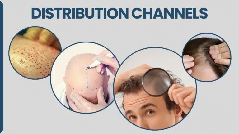 Hair Transplant Us Vs Turkey – Cost, Quality And Key Facts Hair Restoration Excellence You Can Trust