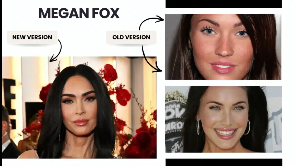 Eyebrow Transplant In Turkey – Cost, Before &Amp; After Hair Restoration Excellence You Can Trust