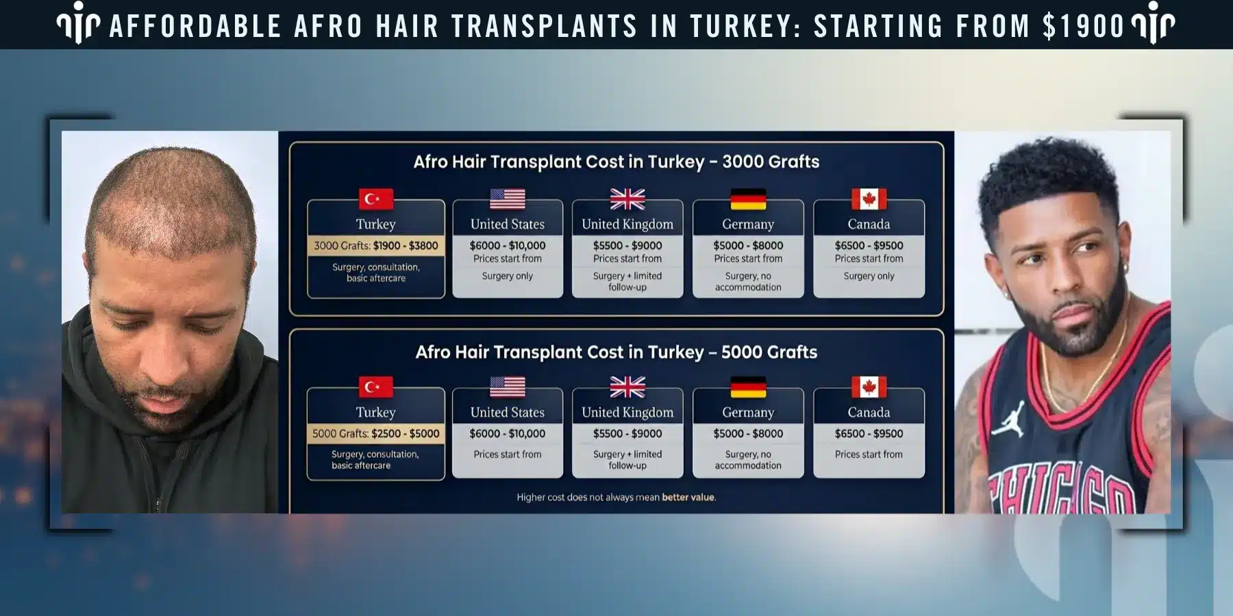 Afro Hair Transplant Cost Varies Depending On The Number Of Grafts, Hair Type, And The Complexity Of The Procedure.