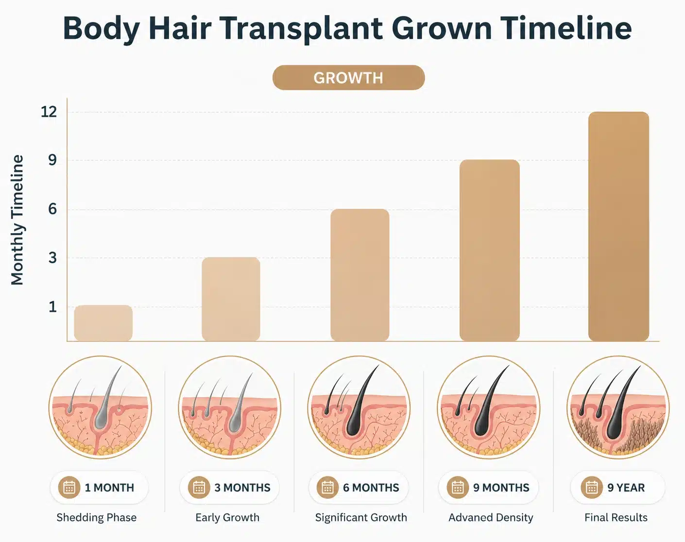 Body Hair Transplant In Turkey: Cost, Procedure &Amp; Before-After 10 Body Hair Transplant In Turkey: Cost, Procedure &Amp; Before-After Hair Restoration Excellence You Can Trust
