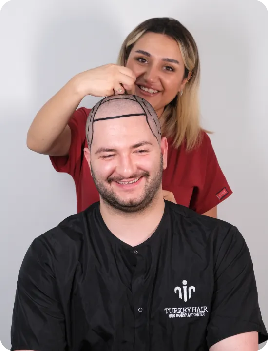 Home Hair Restoration Excellence You Can Trust