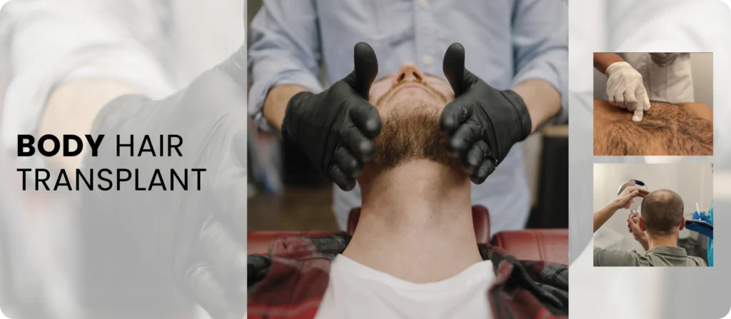 Body Hair Transplant Body Hair Transplant