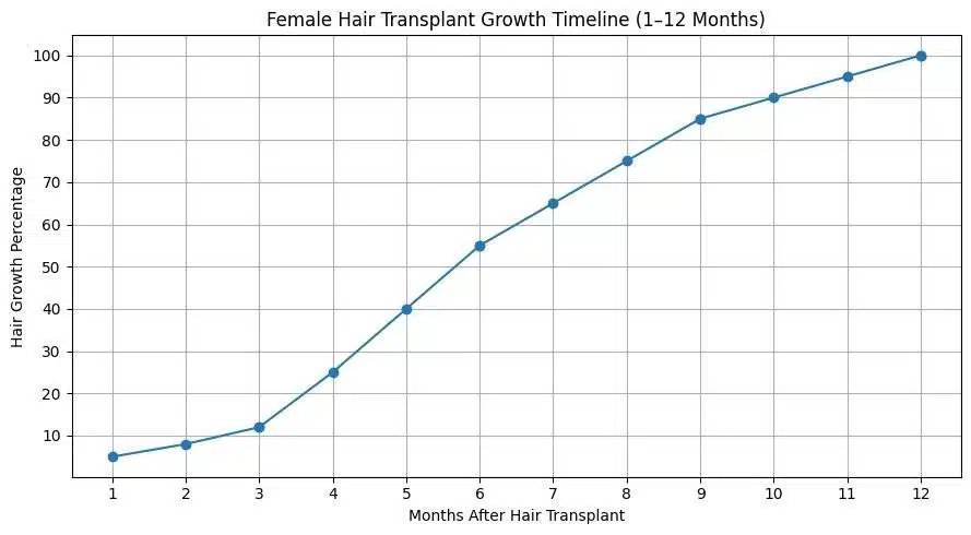 Female Hair Transplant In Turkey – Cost – Before And After Hair Restoration Excellence You Can Trust