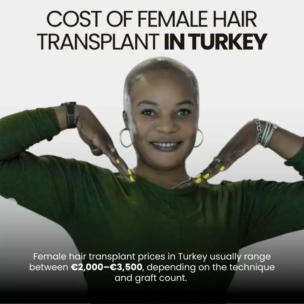Cost Of Female Hair Transplant In Turkey
