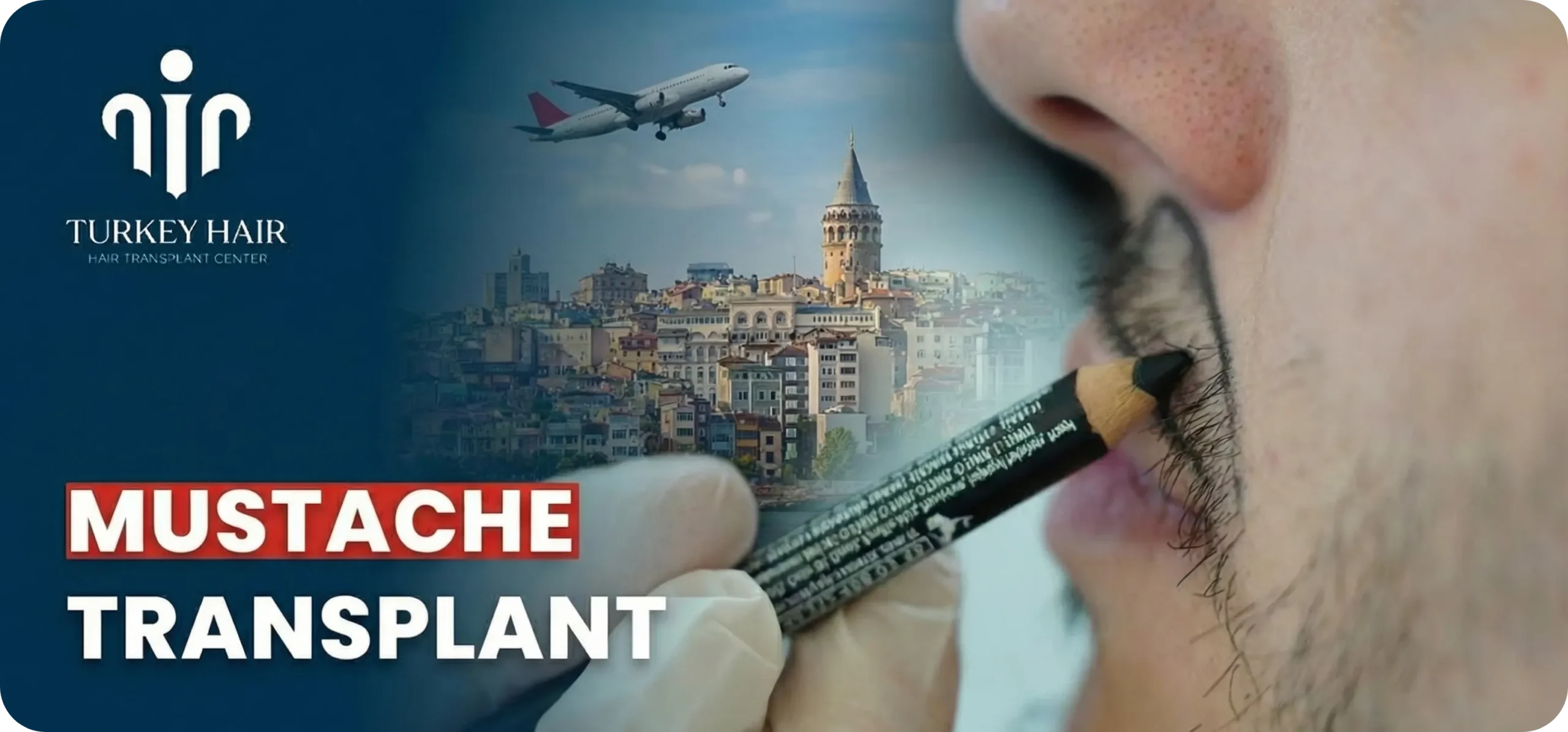 Mustache Transplant In Turkey: Cost – Before And After Hair Restoration Excellence You Can Trust
