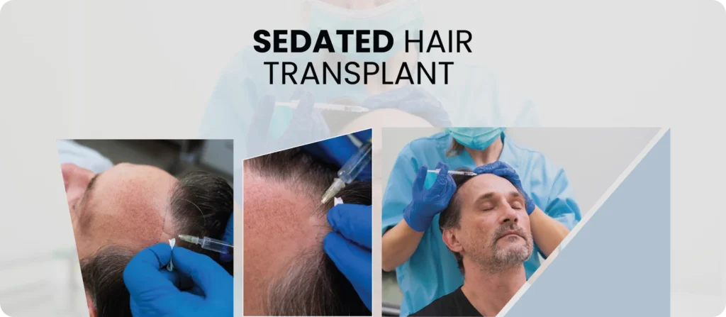 Sedated Hair Transplant Sedated Hair Transplant