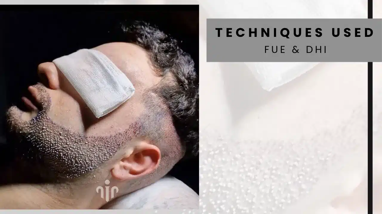Transplantation-Technique