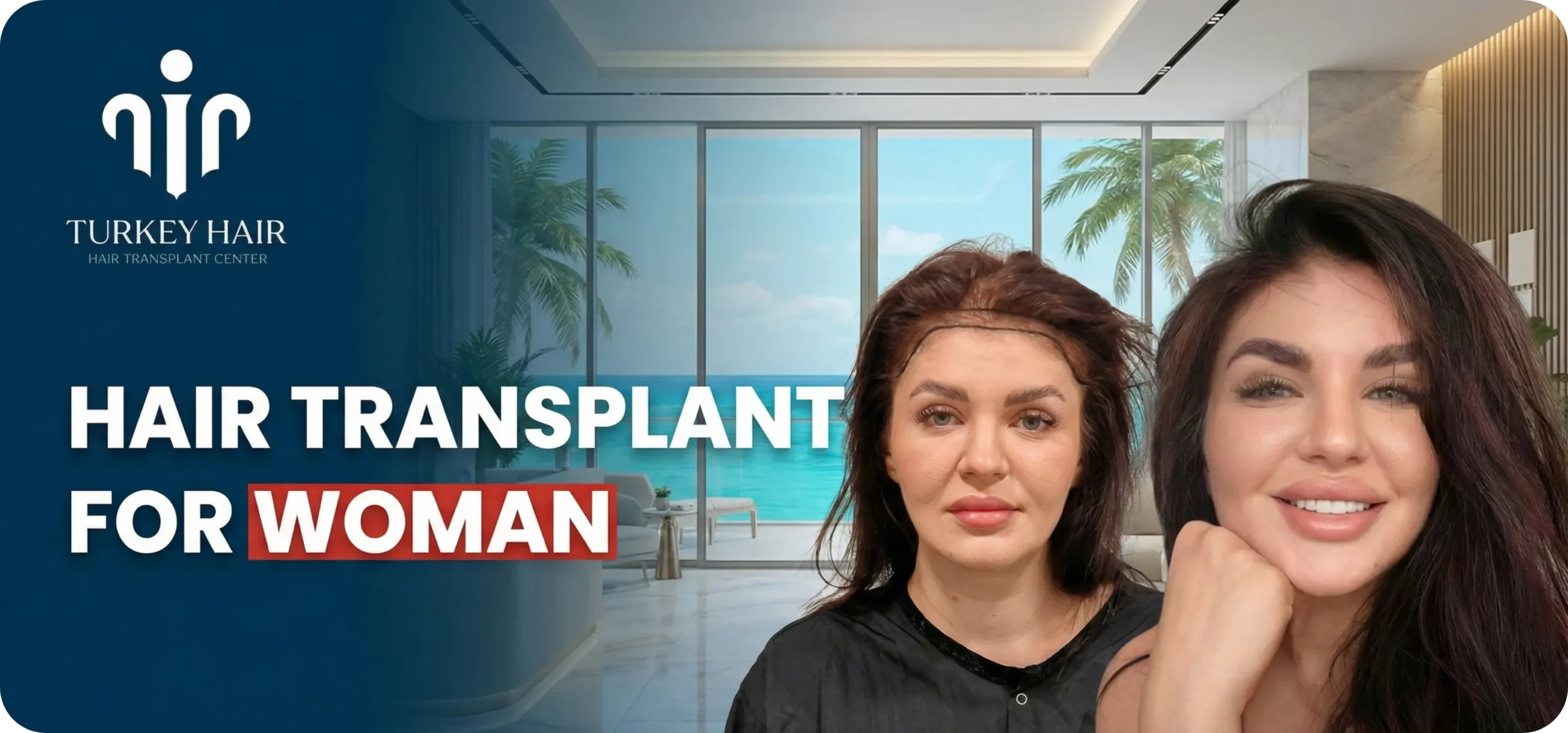 Female Hair Transplant In Turkey – Cost – Before And After Hair Restoration Excellence You Can Trust