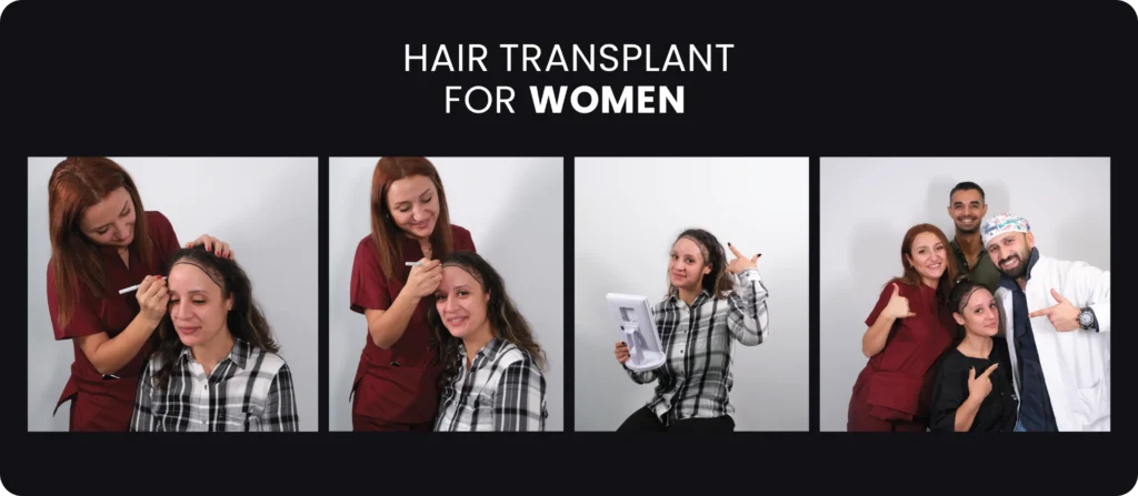Hair Transplant For Women