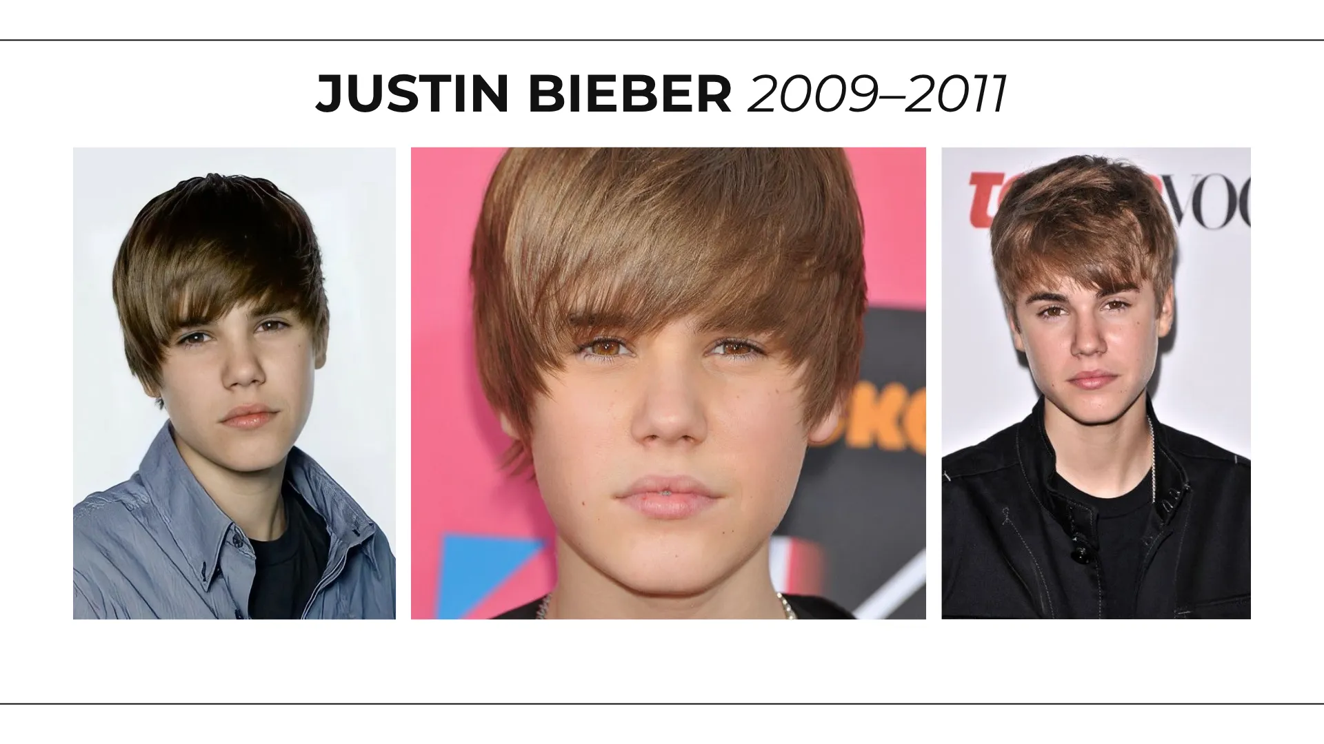 Justin Bieber 2009–2011 hairline comparison showing early hairstyle and frontal hair coverage changes