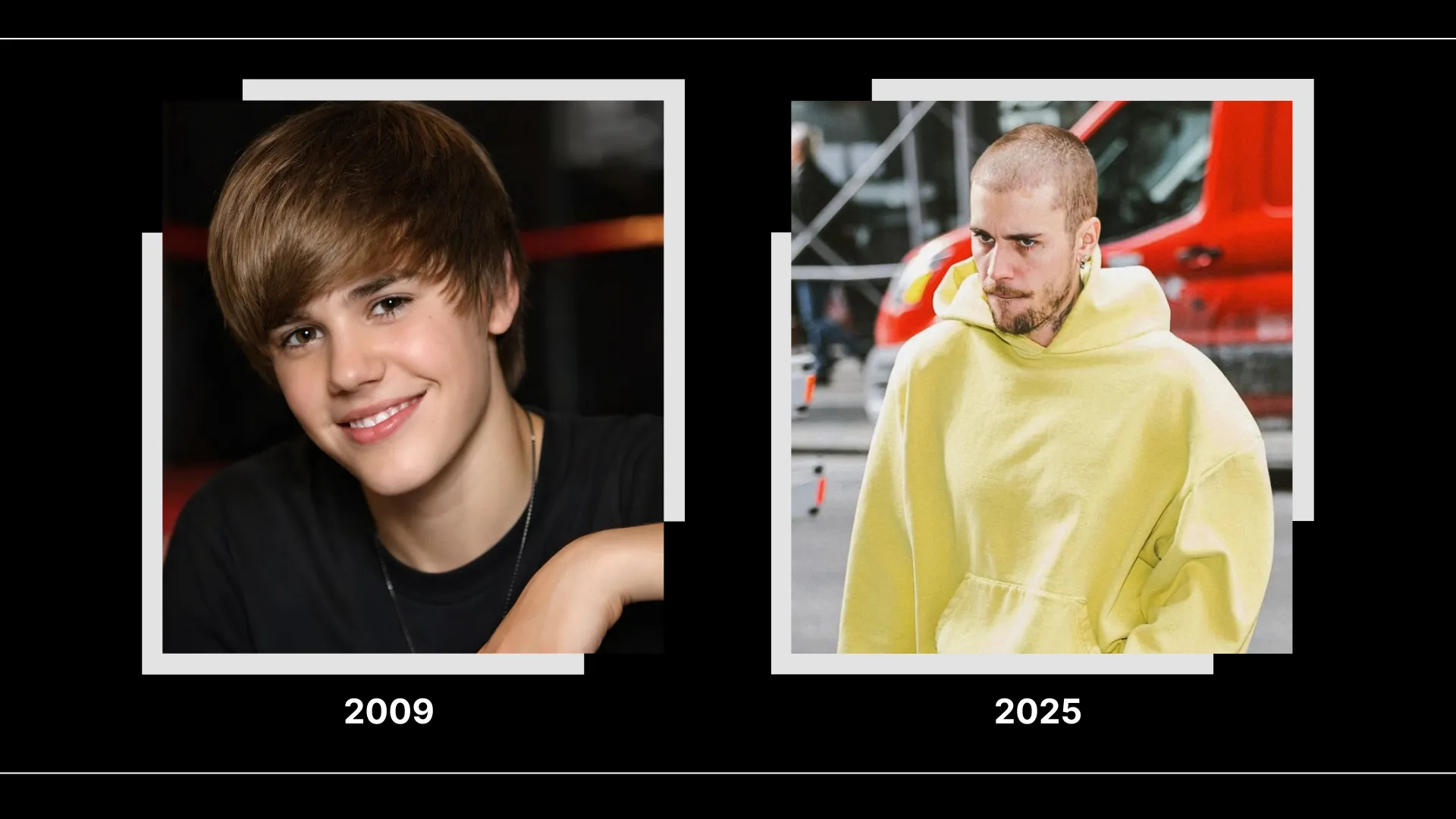 Justin Bieber 2009 and 2025 hairline comparison showing visible hairstyle and frontal hair coverage changes