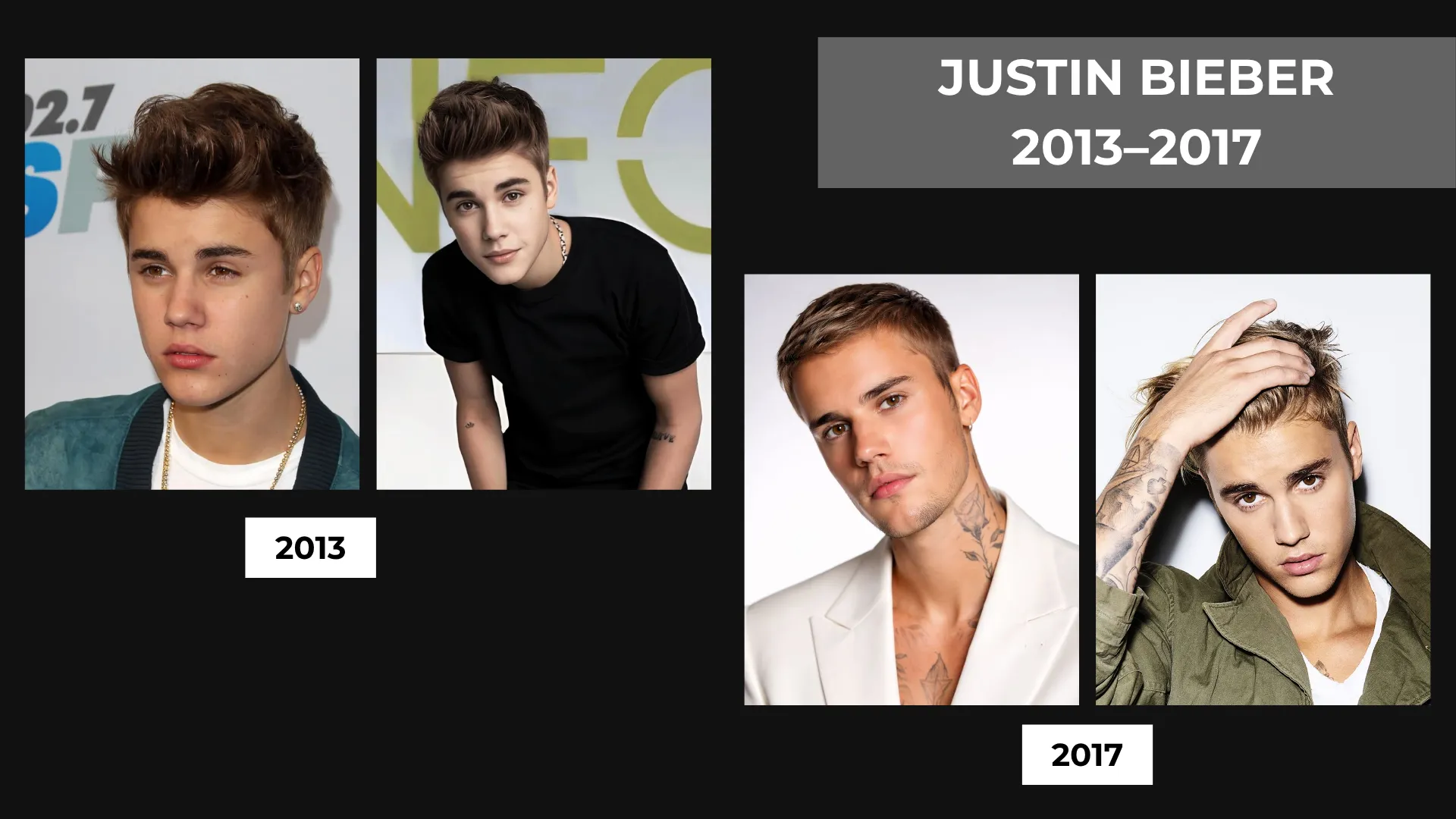 Justin Bieber Hair Transplant: Hairline Analysis, Before &Amp; After Photos, Rumors &Amp; Expert Opinion 6 Justin Bieber 2013 And 2017 Hairline Comparison Showing Changes In Hairstyle, Forehead Visibility, And Frontal Hair Coverage