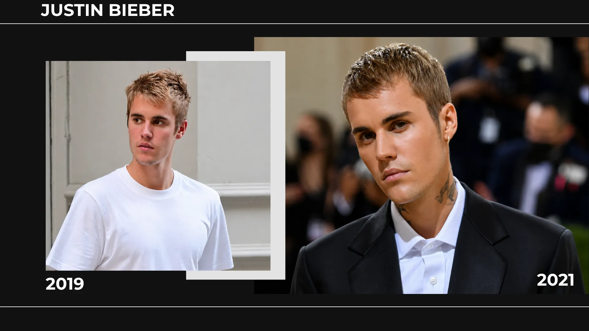Justin Bieber 2019 and 2021 hairline comparison showing hairstyle, forehead visibility, and frontal hair coverage changes