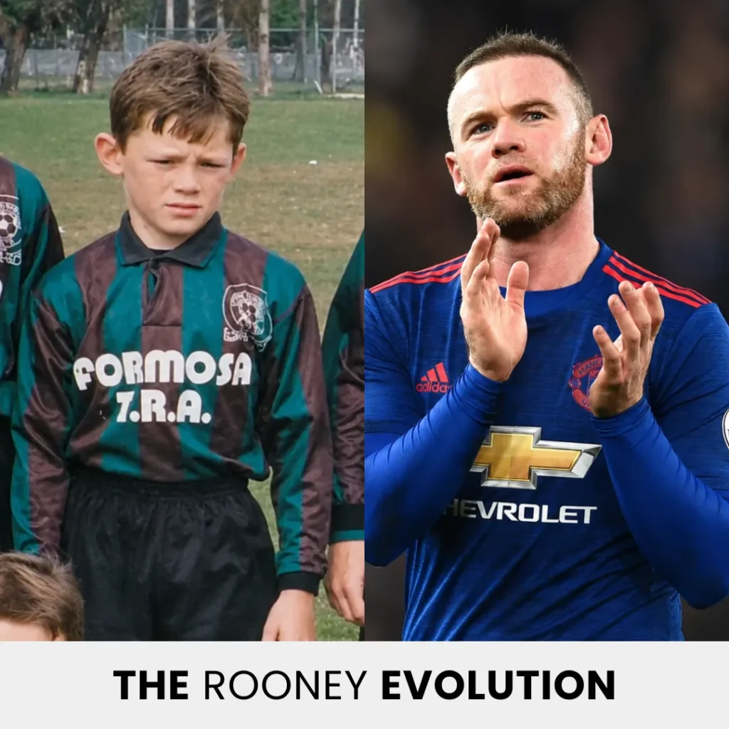 Wayne Rooney Hair Transplant: Before &Amp; After 4 Wayne Rooney Evolution From Childhood Football Player To Manchester United Star With A Mature Hairline Appearance