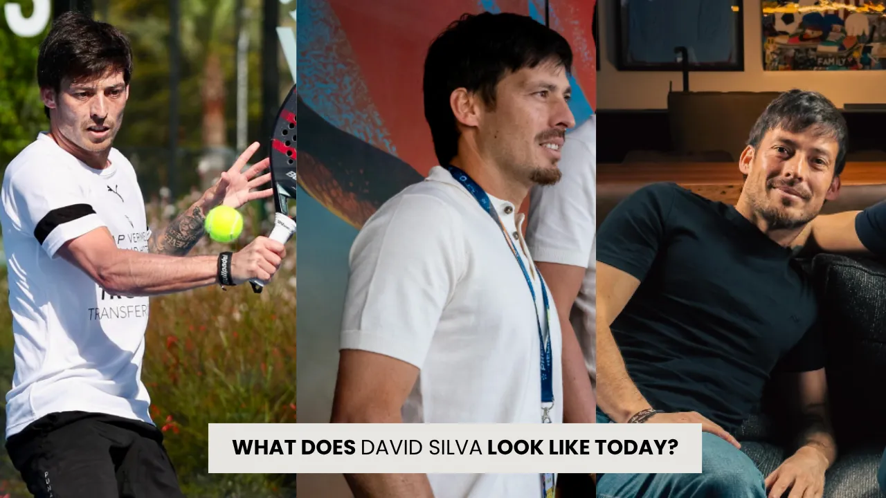 David Silva Hair Transplant: Before &Amp; After 4 David Silva Hair Transplant Before And After Comparison Showing Hairline Restoration And Improved Hair Density Over Time
