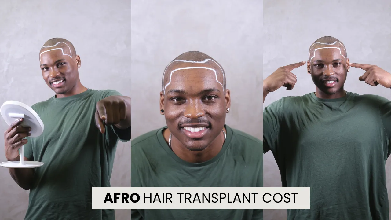 Afro Hair Transplant Cost In Turkey Guide With Afro Hairline Design Consultation
