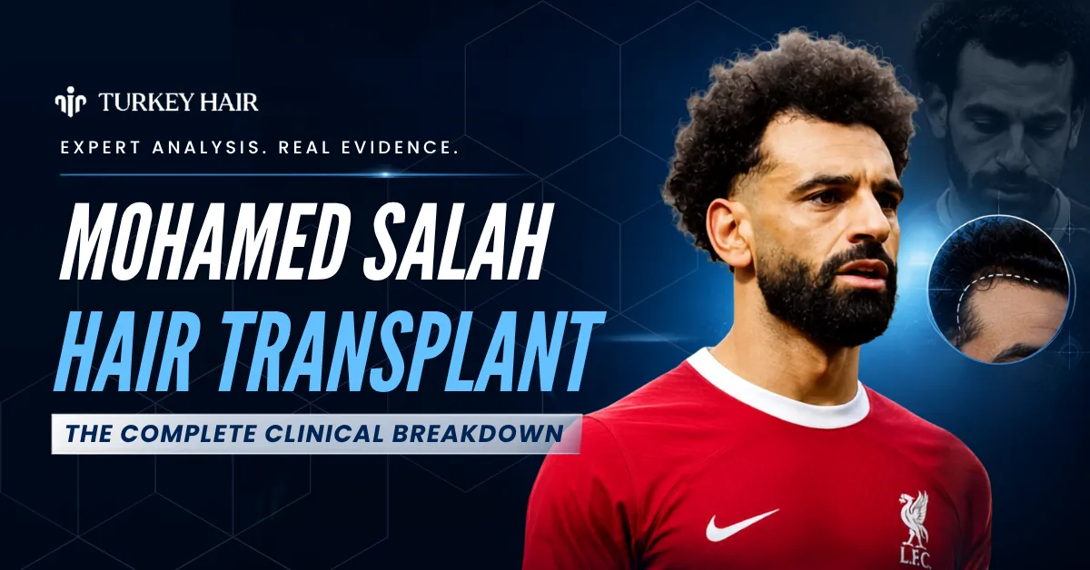 Mohamed Salah Hair Transplant: Before & After Photos, Graft Count & Expert Analysis