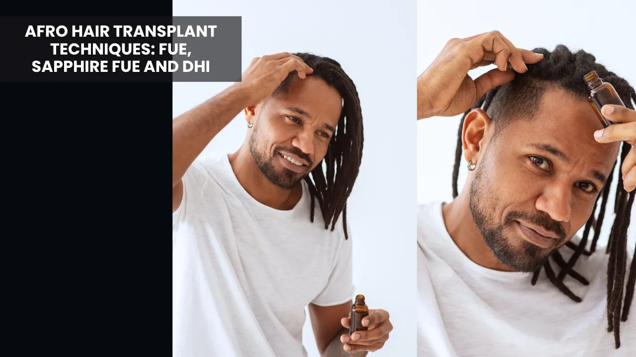 Afro Hair Transplant Techniques Using Fue, Sapphire Fue And Dhi Methods For Afro Textured Hair
