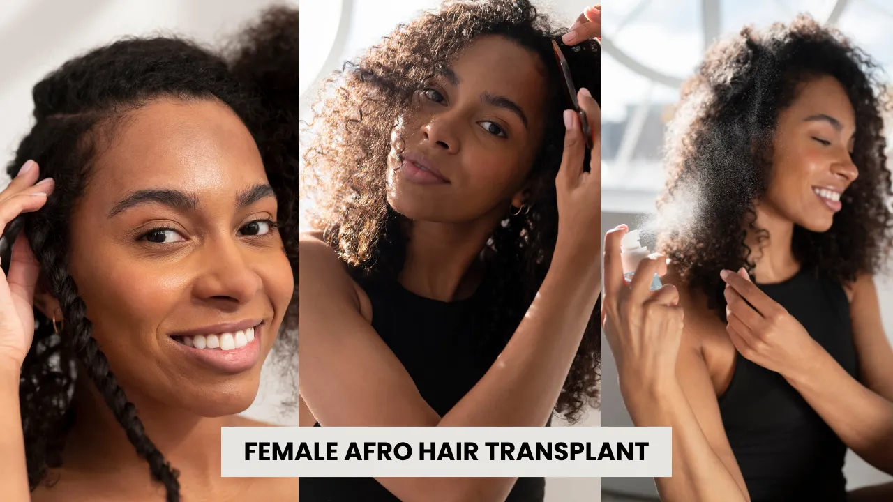 Female Afro Hair Transplant In Turkey – Natural Hair Restoration For Women With Curly And Afro-Textured Hair