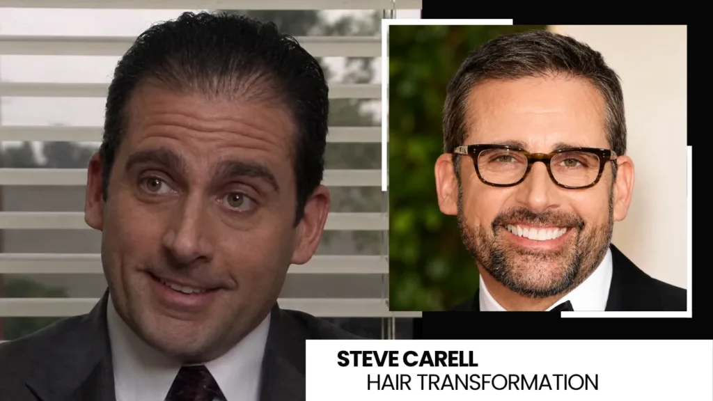 Steve Carell Hair Transformation Before And After Comparison Showing Early Receding Hairline And Later Fuller Hair